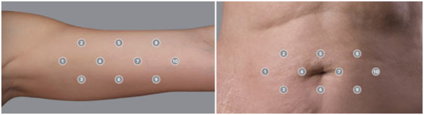 image 2 showing the concept of The New Premium Therapy for Sagging Skin Areas