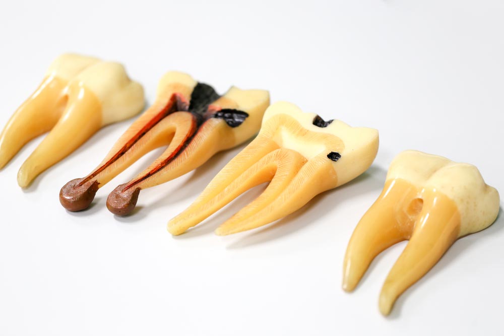 Tooth model for education in laboratory