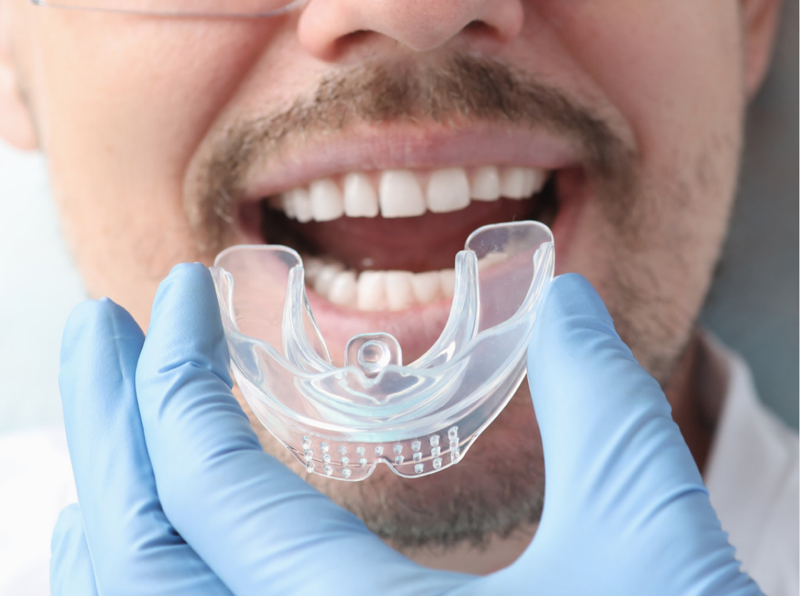 An oral appliance used for sleep apnea treatment in grand prairie and excessive snoring by Dentistry On 43
