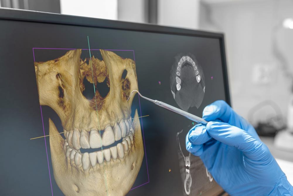 Dentist showing 3D tomography image on screen