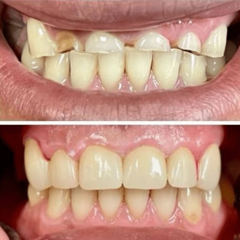 Before and after treatment