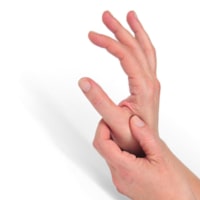 Thumb<br> Arthritis