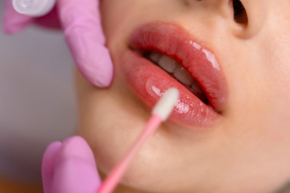What to Know Before Your First Lip Filler Appointment 9 used to demonstrate the concept of What to Know Before Your First Lip Filler Appointment lip filler