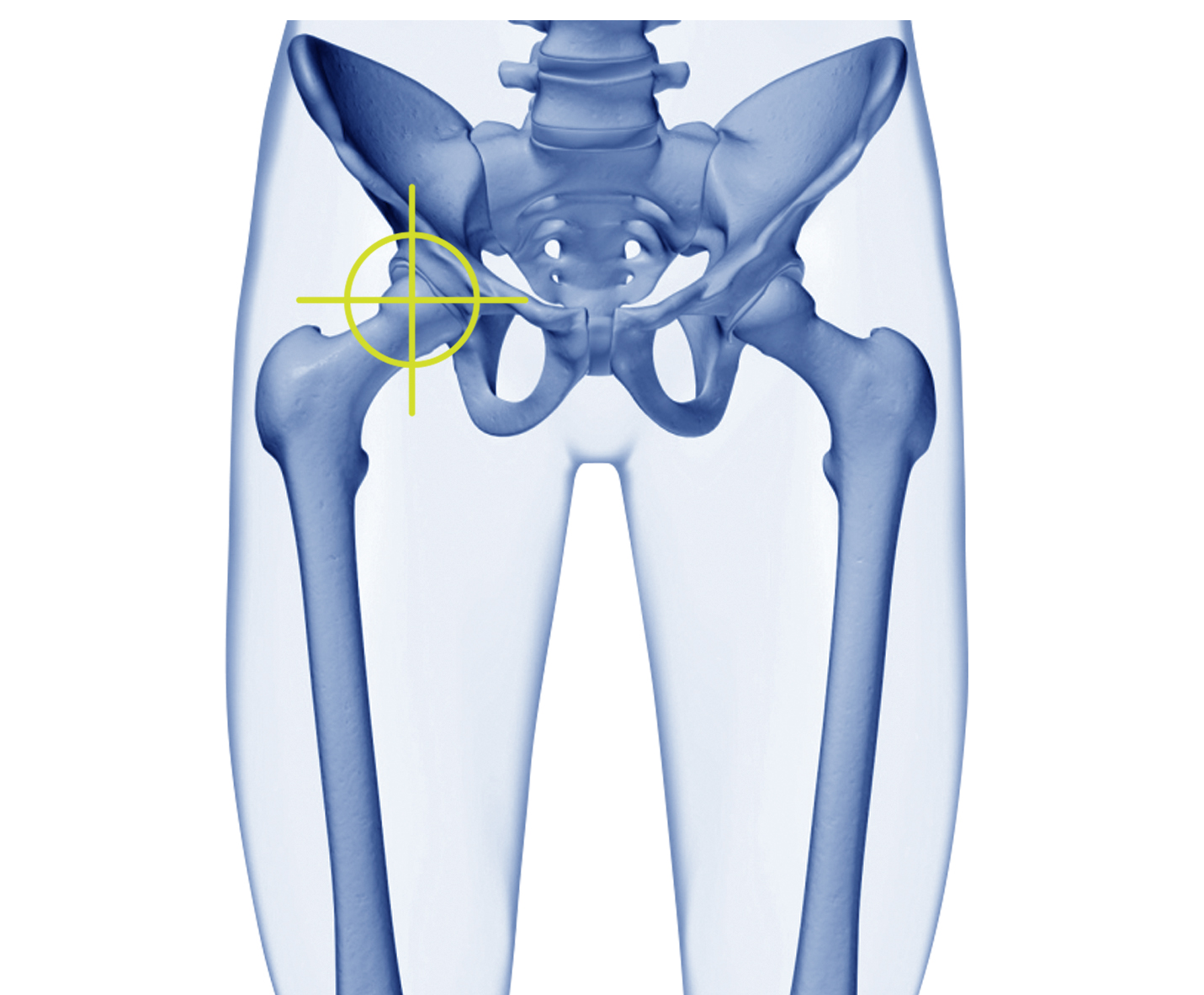hip align graphic x.ray