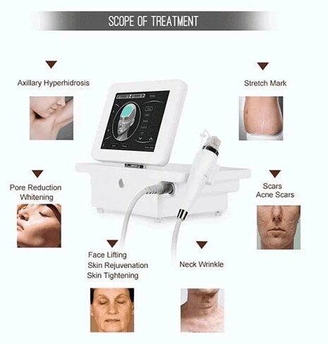 Microneedling treatment