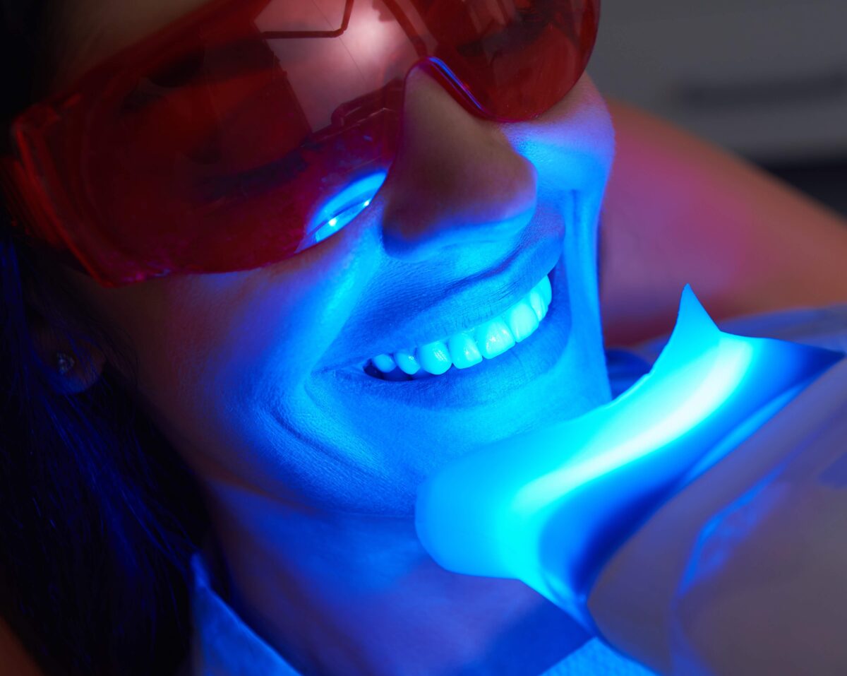 Professional Teeth Whitening in Punta Gorda, FL