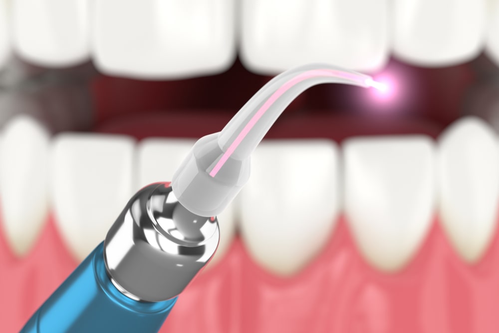 The concept of using laser therapy in the treatment of gums