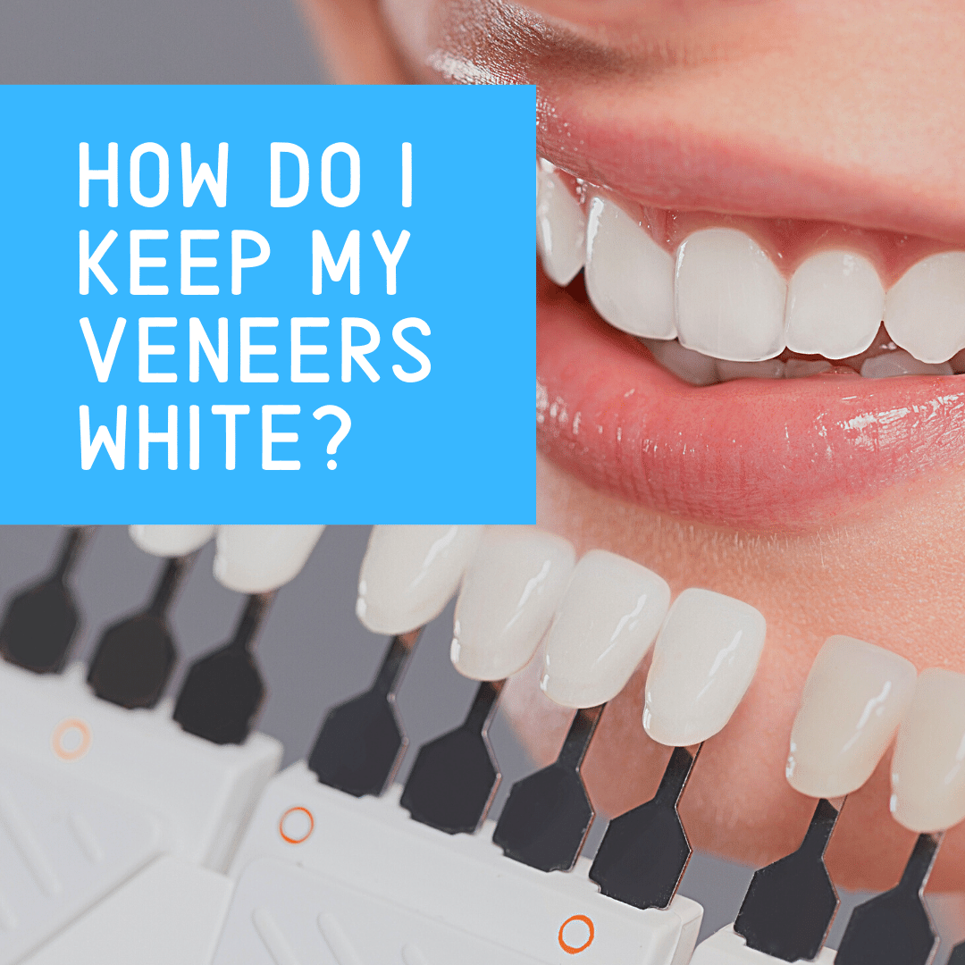 How Do I Keep My Veneers White