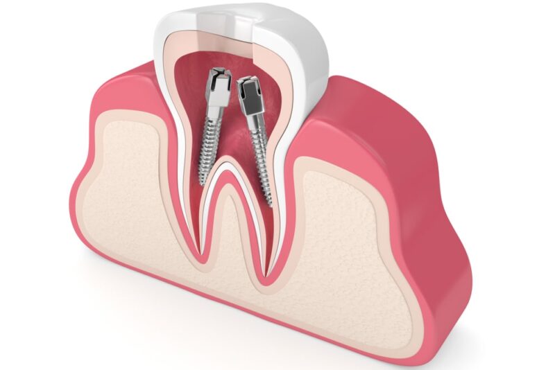 Laser Dental Bakersfield Dentist in Bakersfield, CA