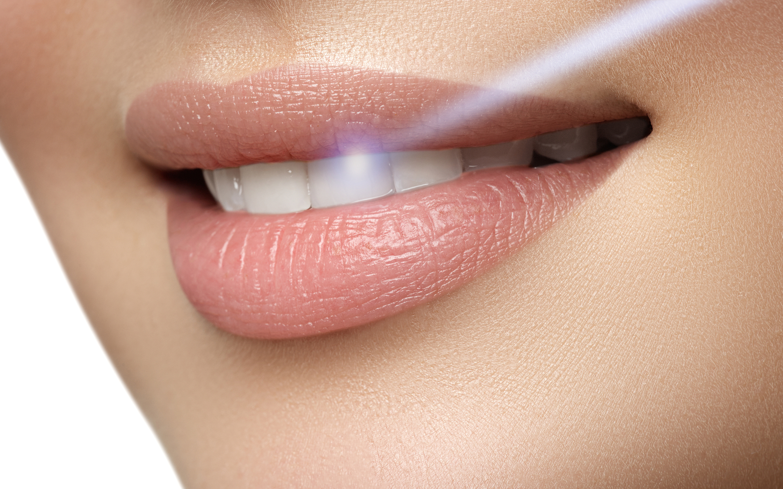 Woman undergoing laser dentistry.