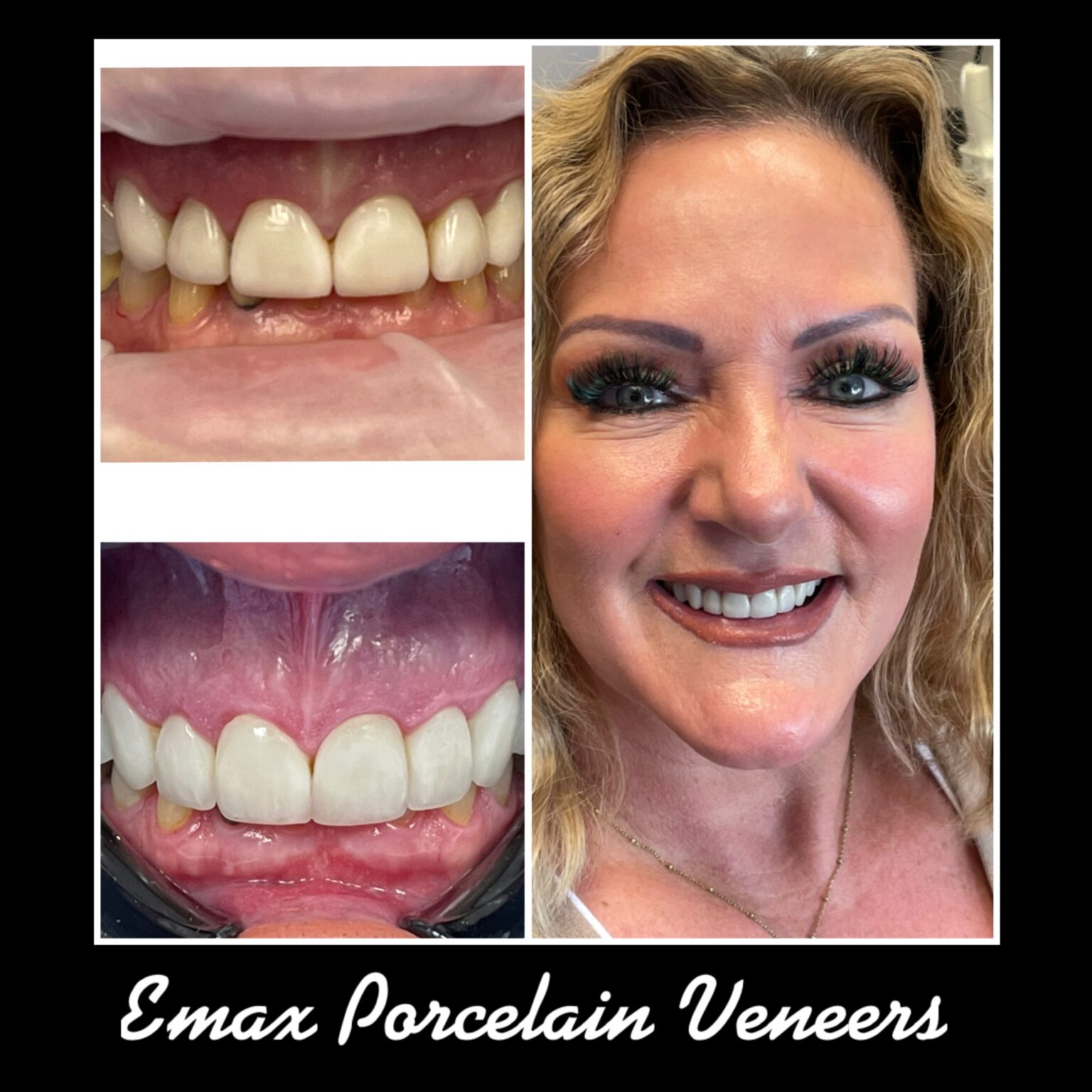 Smile Gallery Laser Dental Bakersfield Bakersfield, CA