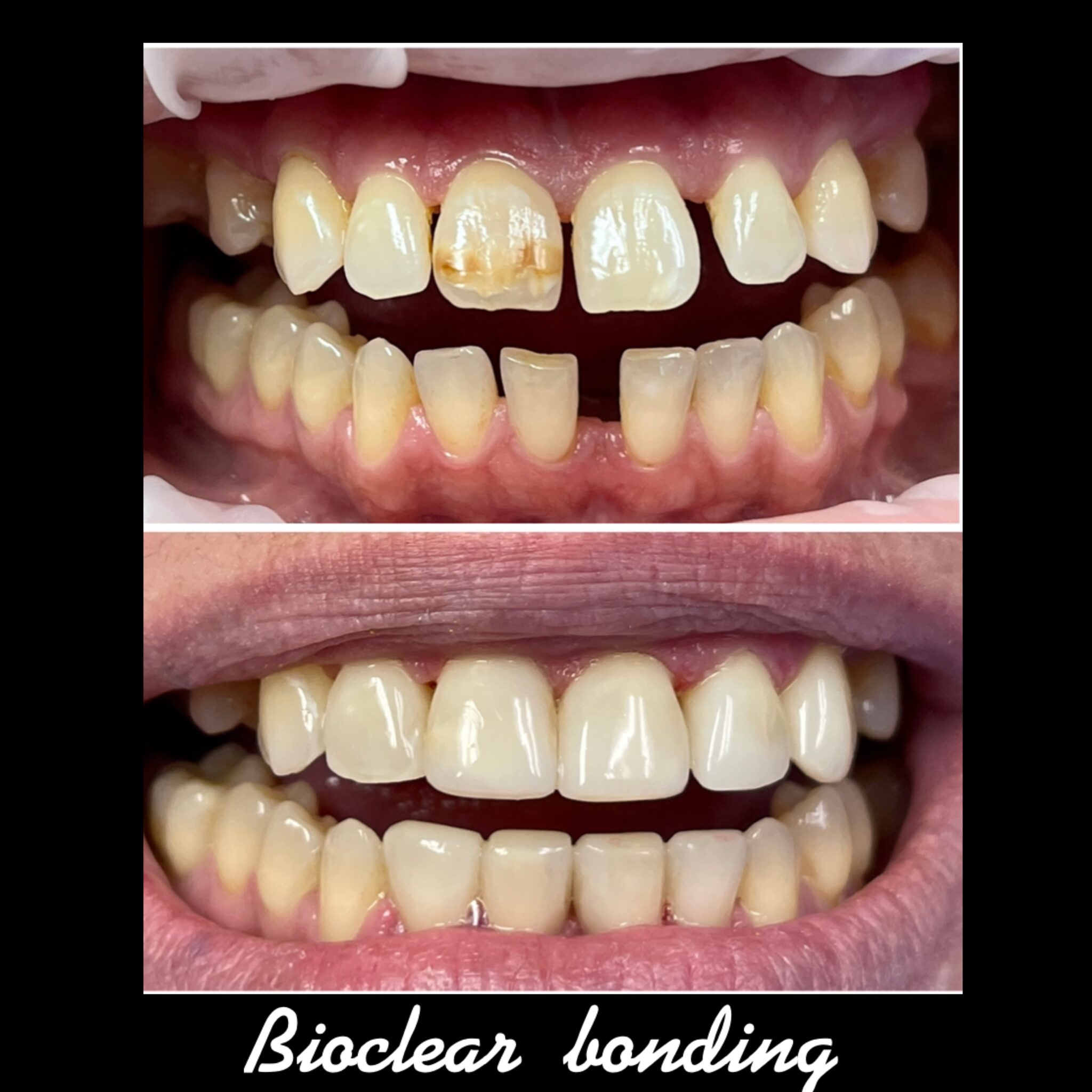 Smile Gallery Laser Dental Bakersfield Bakersfield, CA