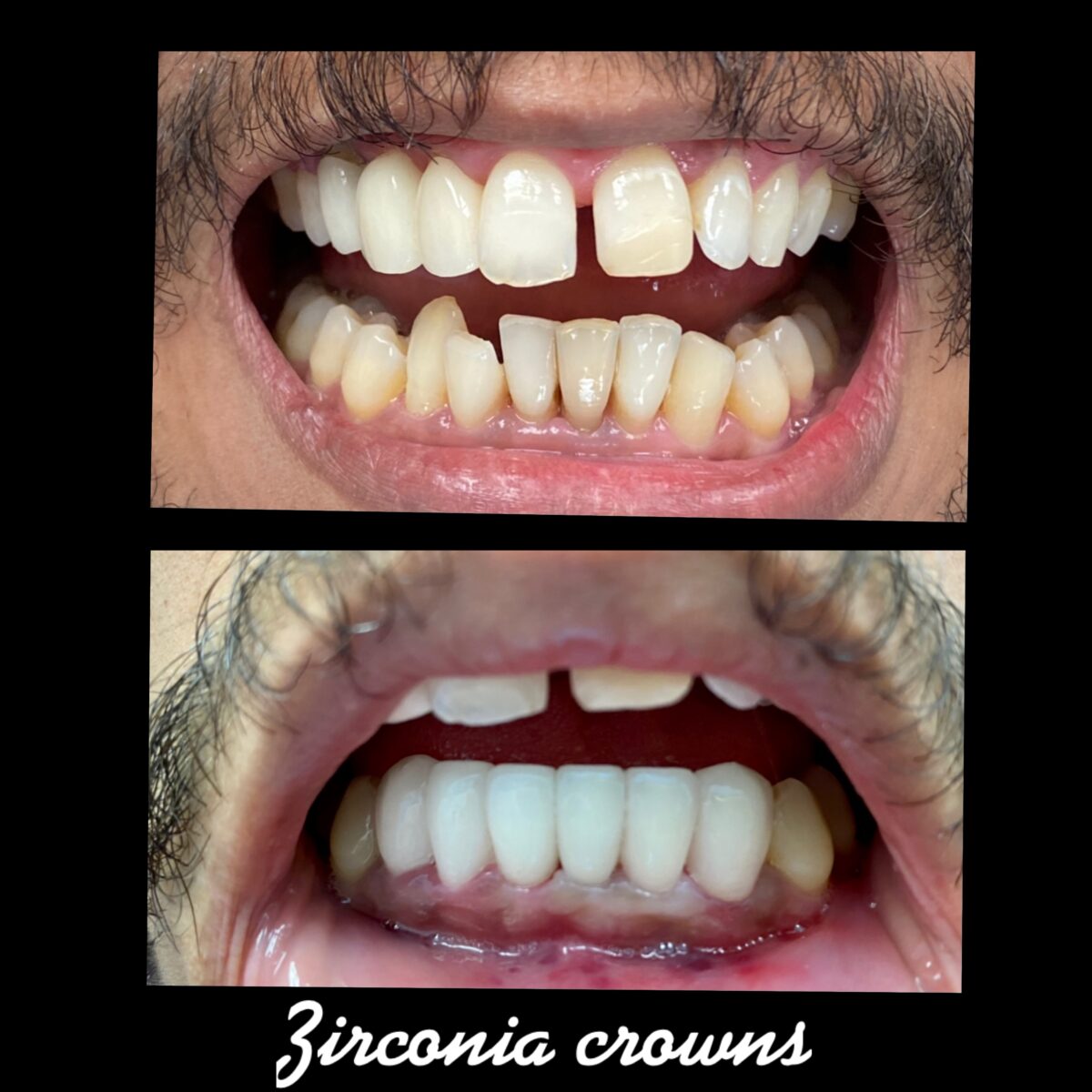 Smile Gallery Laser Dental Bakersfield Bakersfield, CA