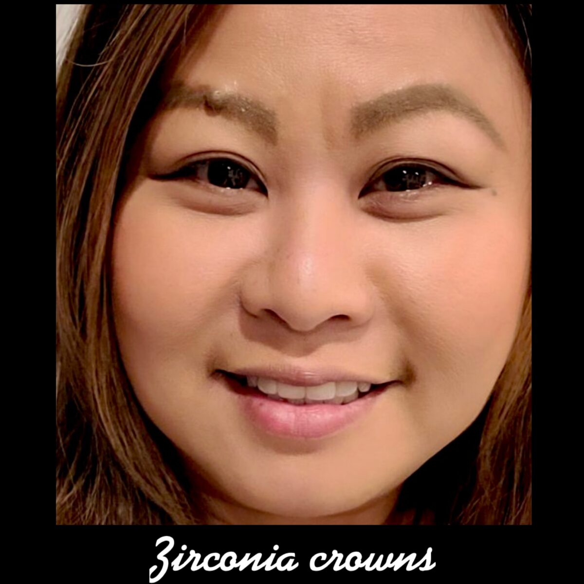 Smile Gallery Laser Dental Bakersfield Bakersfield, CA