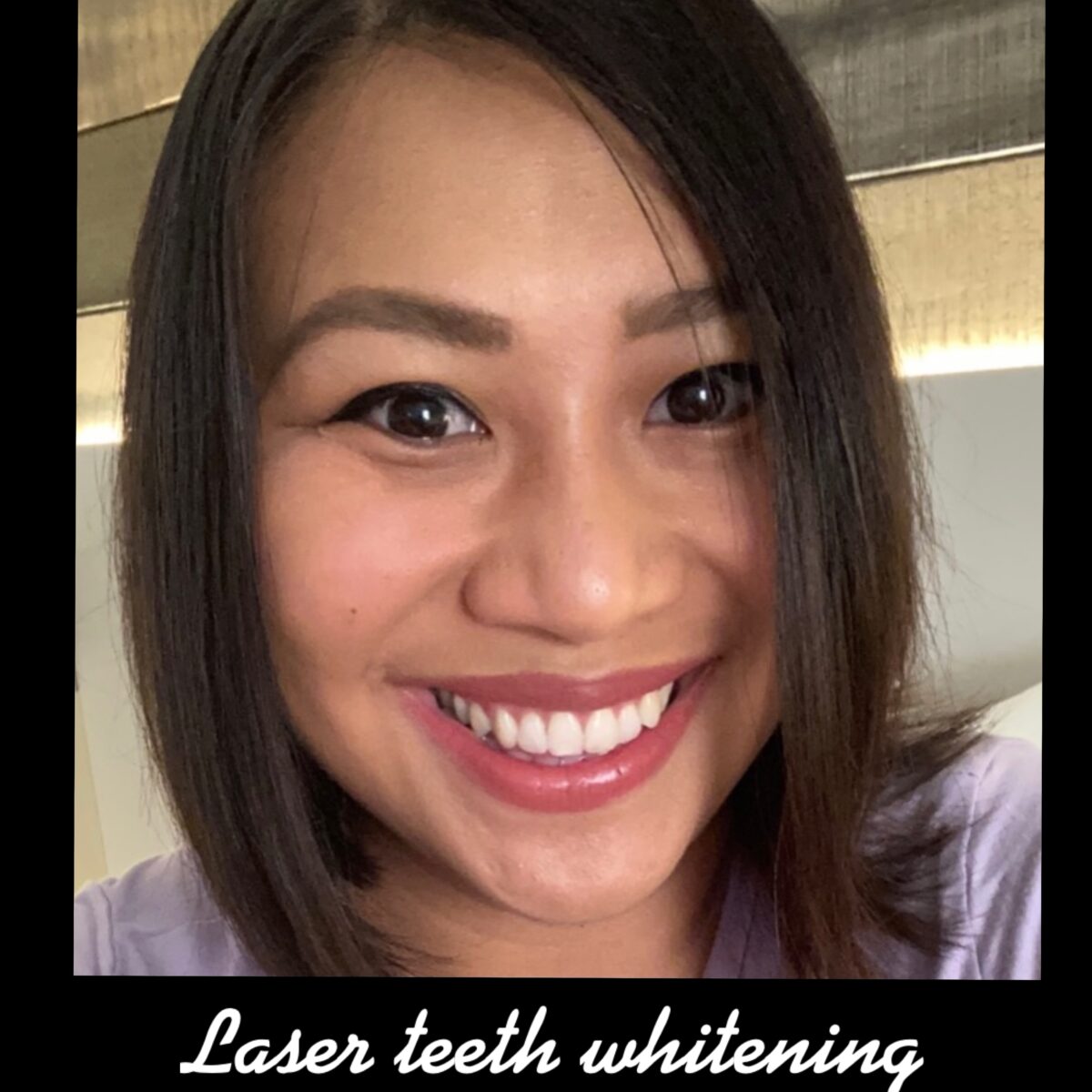 Smile Gallery Laser Dental Bakersfield Bakersfield, CA