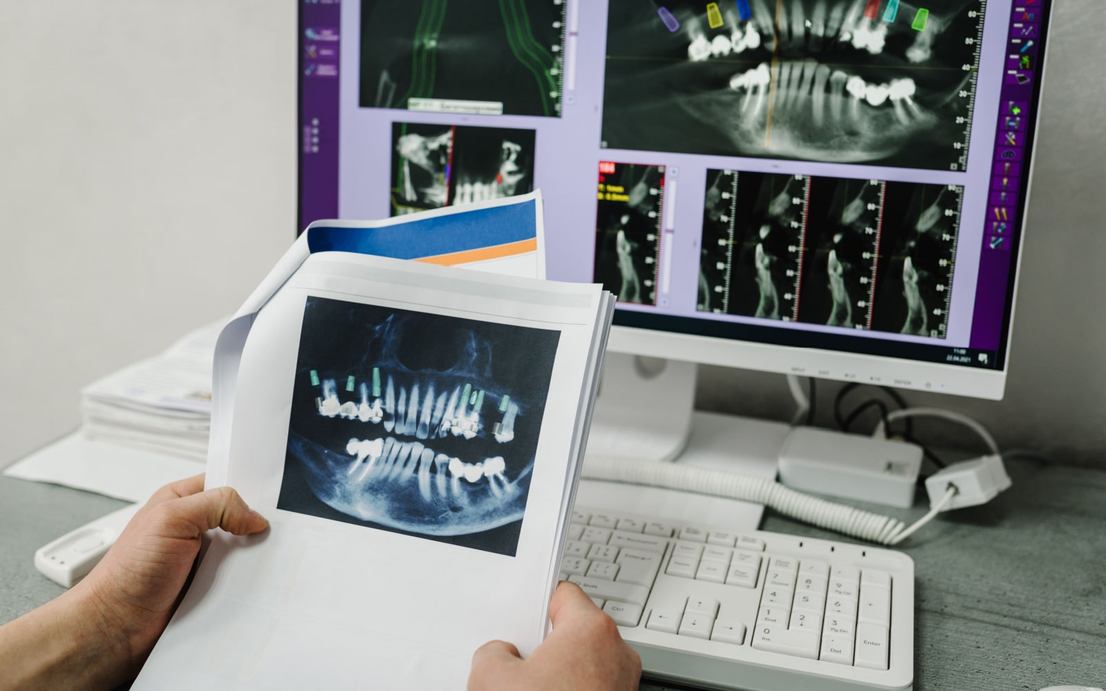 Preview of X-Ray and Digital Imaging For Dentist Appointment