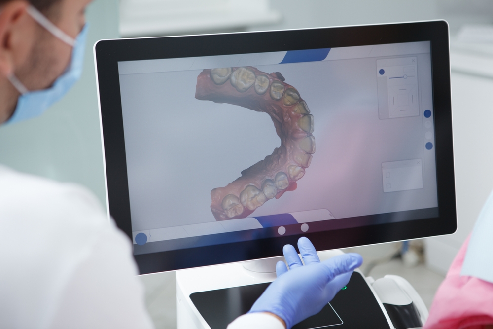 An example of 3D Dental Scanning