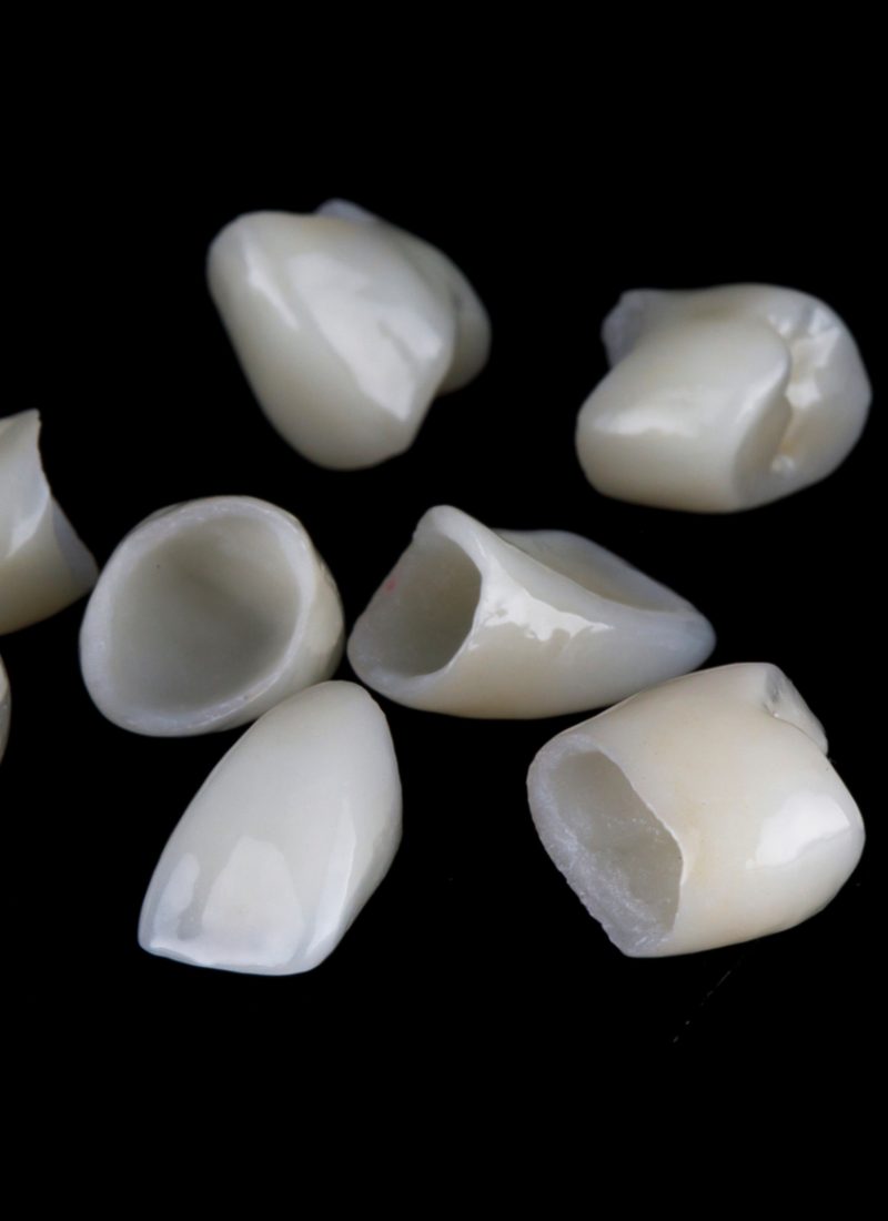 ceramic crowns for total prosthetics of the patient