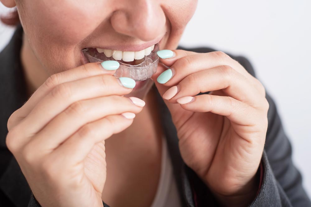 woman uses transparent braces