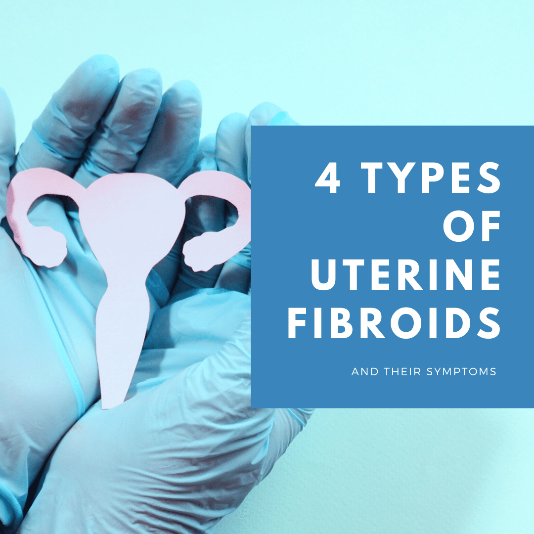 4 Types of Uterine Fibroids