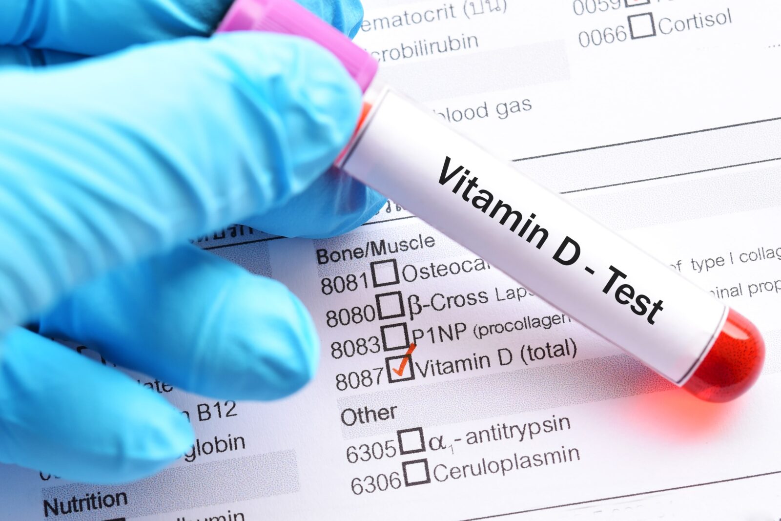vitamin D bloodtest