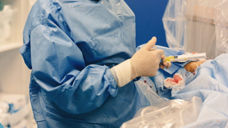 Uterine fibroid embolization procedure by an interventional radiologist blocks blood flow to fibroids in the uterus