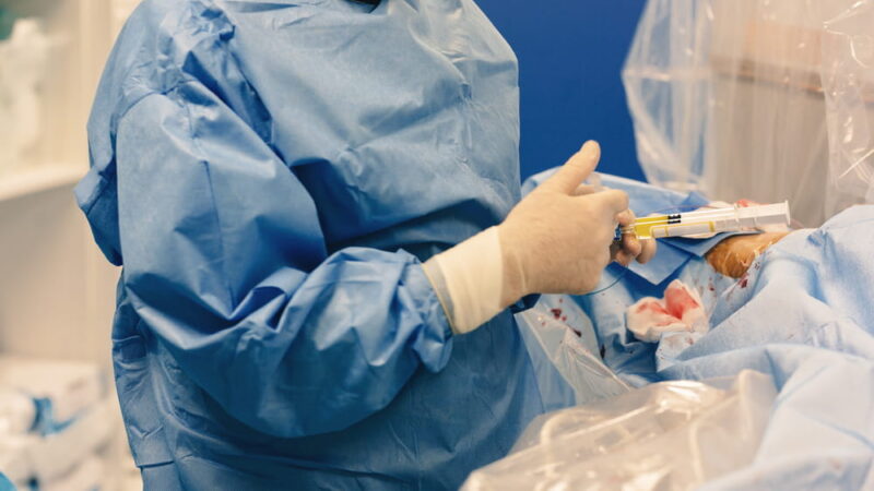 Uterine fibroid embolization procedure by an interventional radiologist blocks blood flow to fibroids in the uterus called uterine artery embolization