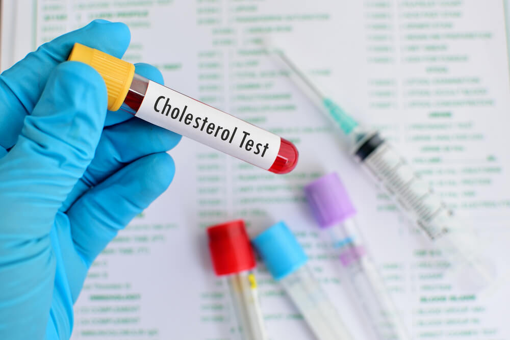 Blood sample for cholesterol testing