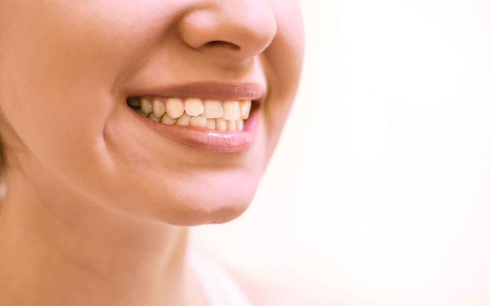 Woman Smiling with Imperfect Teeth