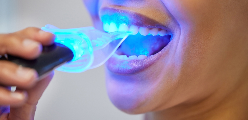 Teeth whitening, LED tool and mouth of person, clinic and treatment in office of dentist