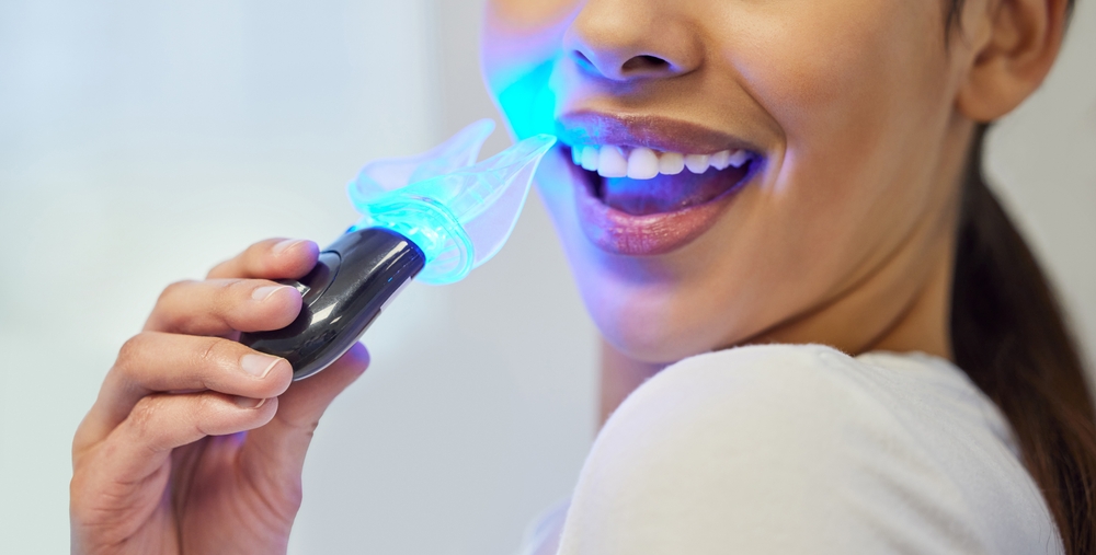 Teeth whitening, LED tool and mouth of patient, smile and treatment in office of dentist and closeup