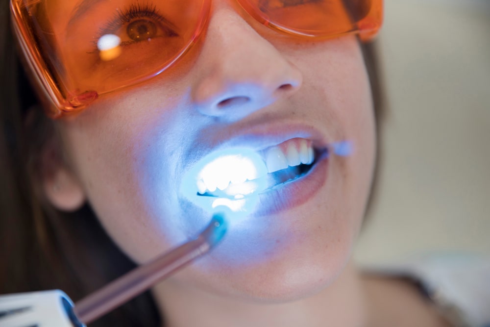 Girl patient in the dental clinic. Teeth whitening UV lamp with photopolymer composition.