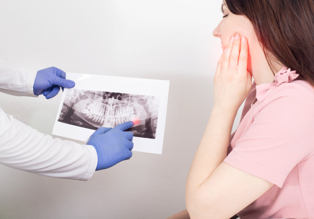 A dentist doctor is holding a panoramic X-ray picture of a female patient who has an inflamed dental cyst