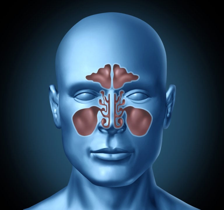 3d image of chronic sinus