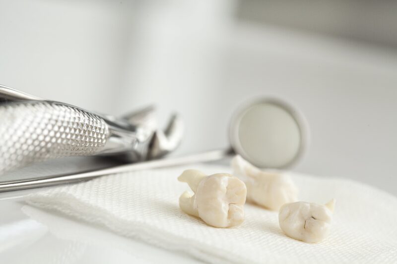 extracted teeth on a piece of gauze beside a dental mirror