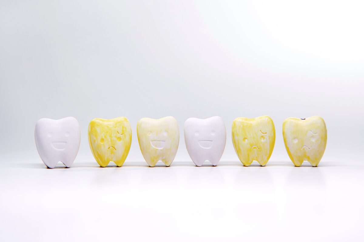 Yellow teeth and whitening teeth model, Yellow teeth that cause a loss of confidence to smile
