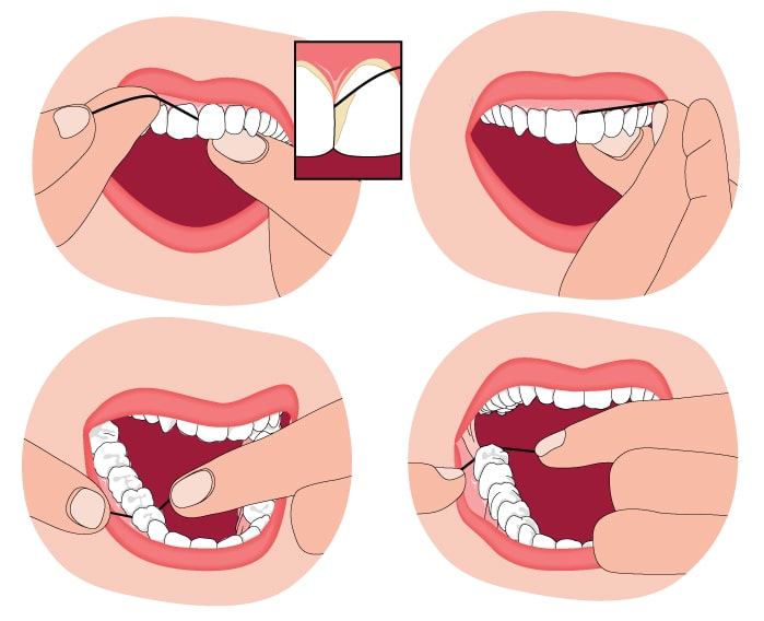 four images showing a step by step process on how to properly floss