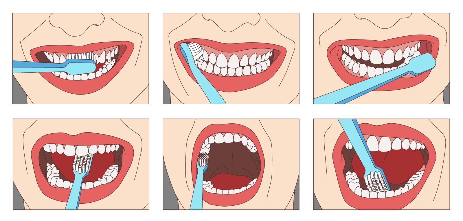 six images showing the steps on how to properly brush your teeth