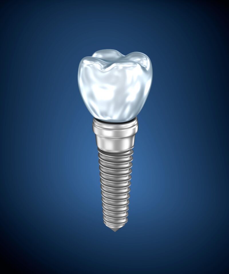 dental implant on blue background