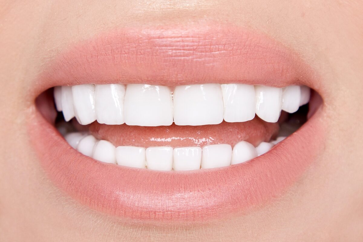 close up of white smile