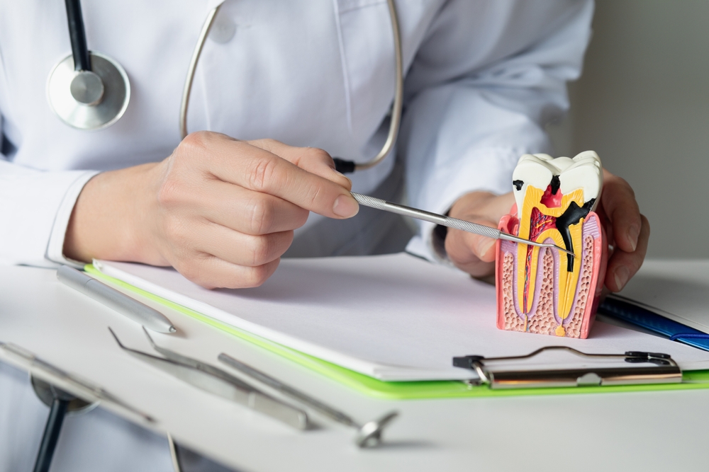 The facts about root canals