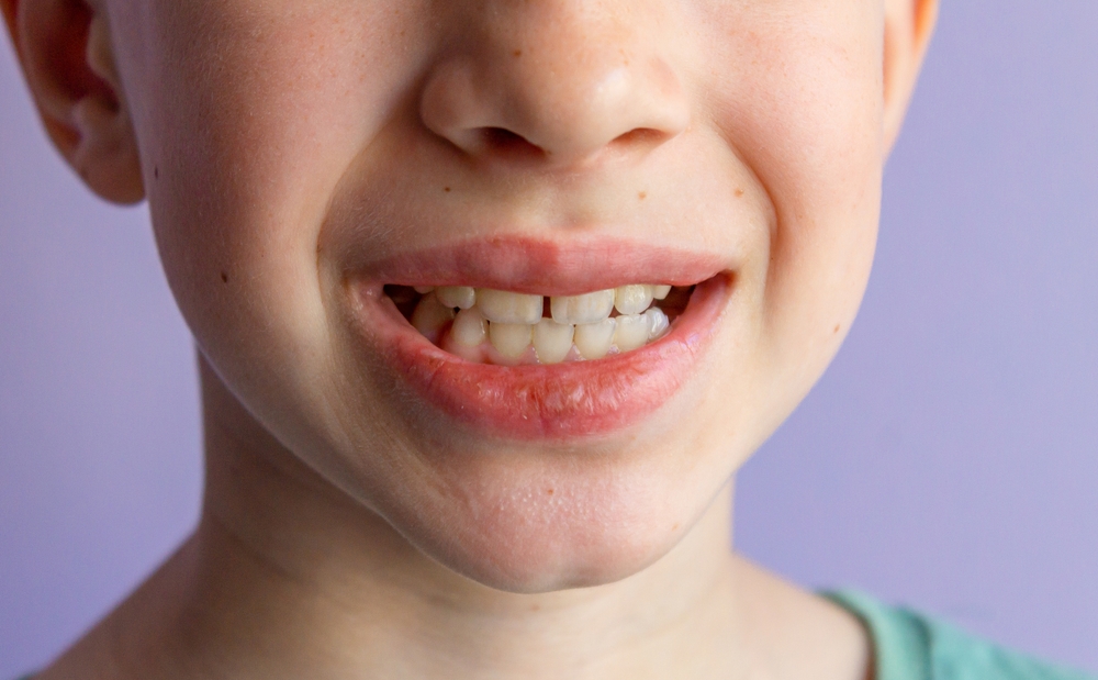 Genetics and oral health: what you need to know