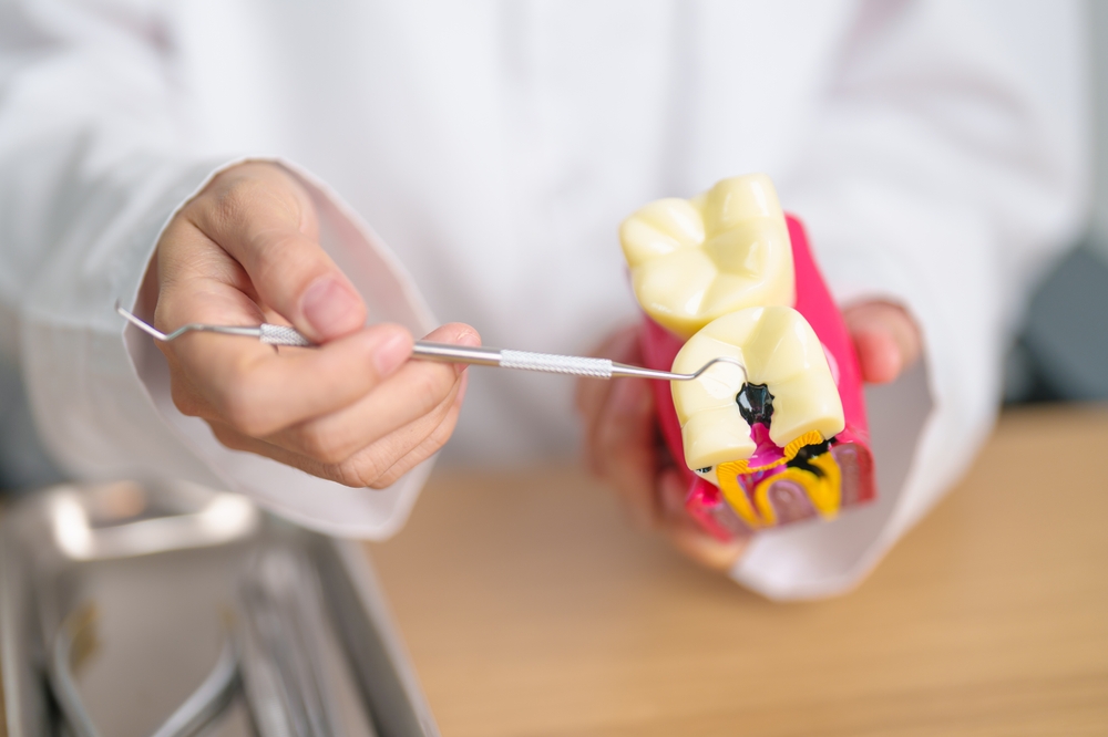 How Long Does It Take for a Cavity to Get Worse?
