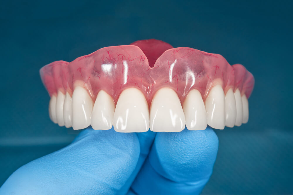 Full removable denture of the upper jaw