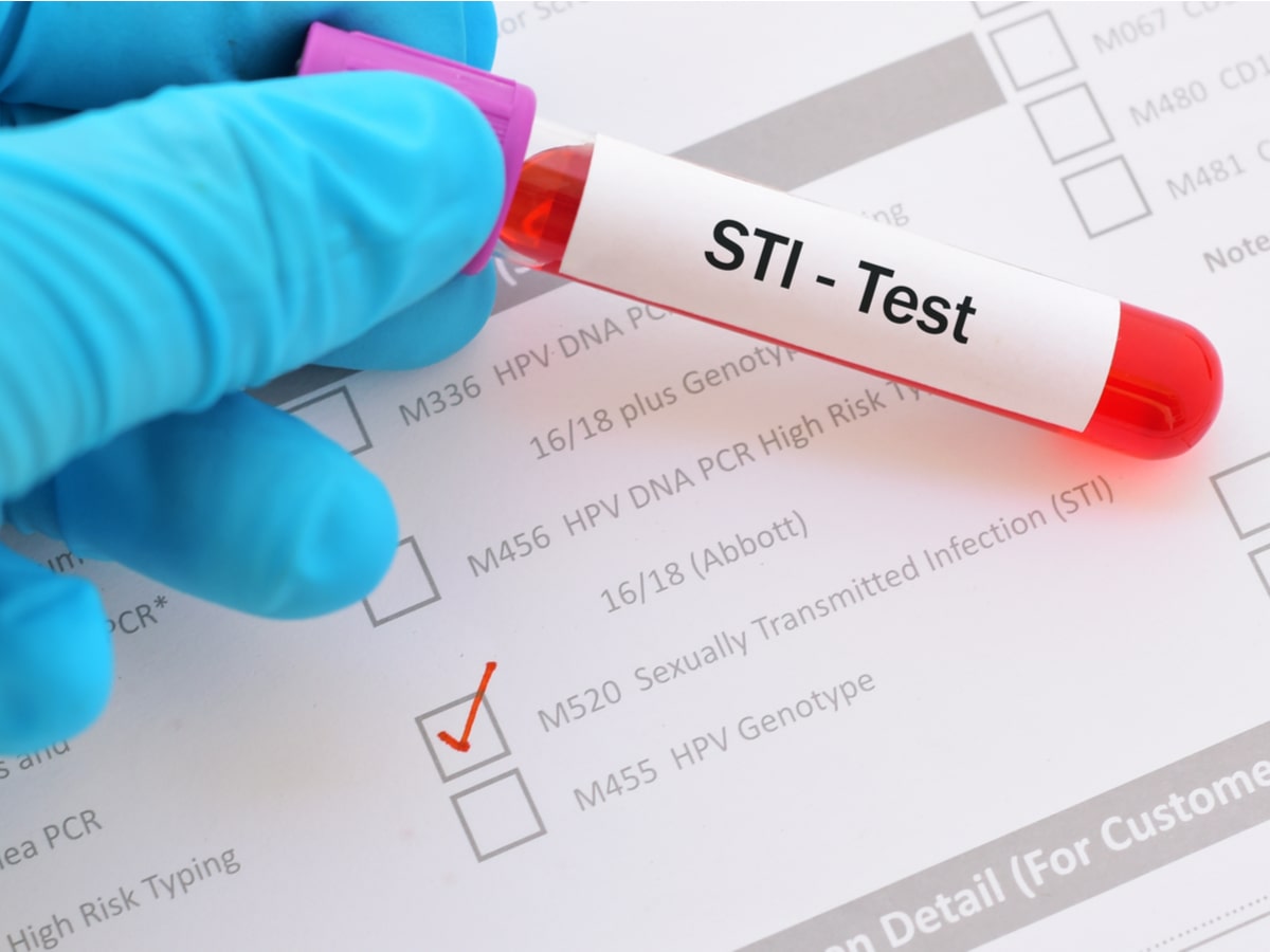 Blood sample for STI (sexually transmitted infection)