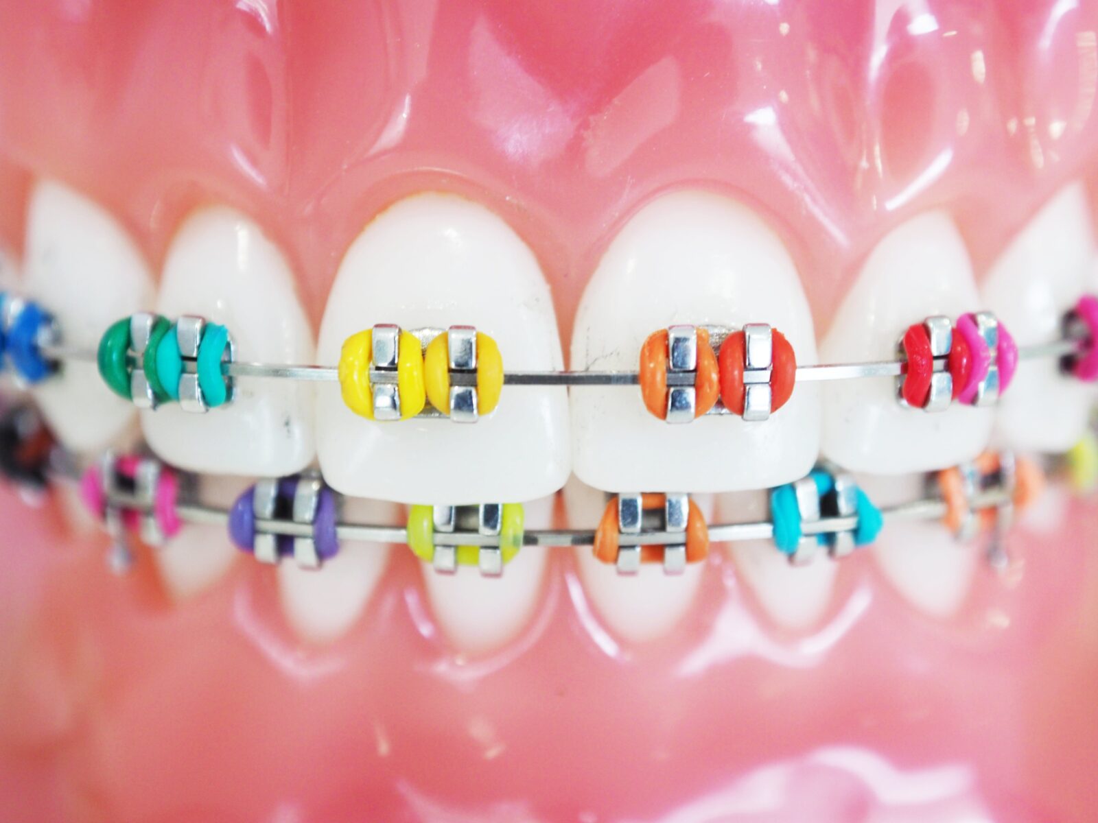 Close up orthodontic model and dentist tool - demonstration teeth model of multi color of orthodontic bracket or brace. colorful braces.