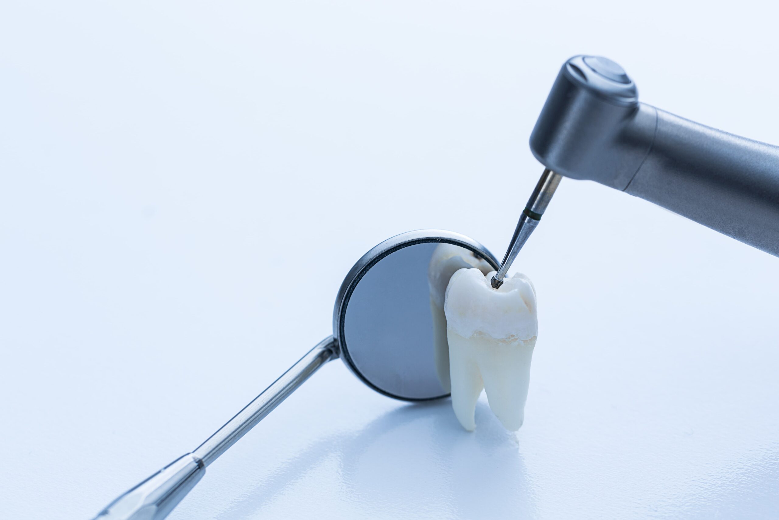 Basic Steps Involved in a Dental Filling Procedure - Fisher Pointe Dental