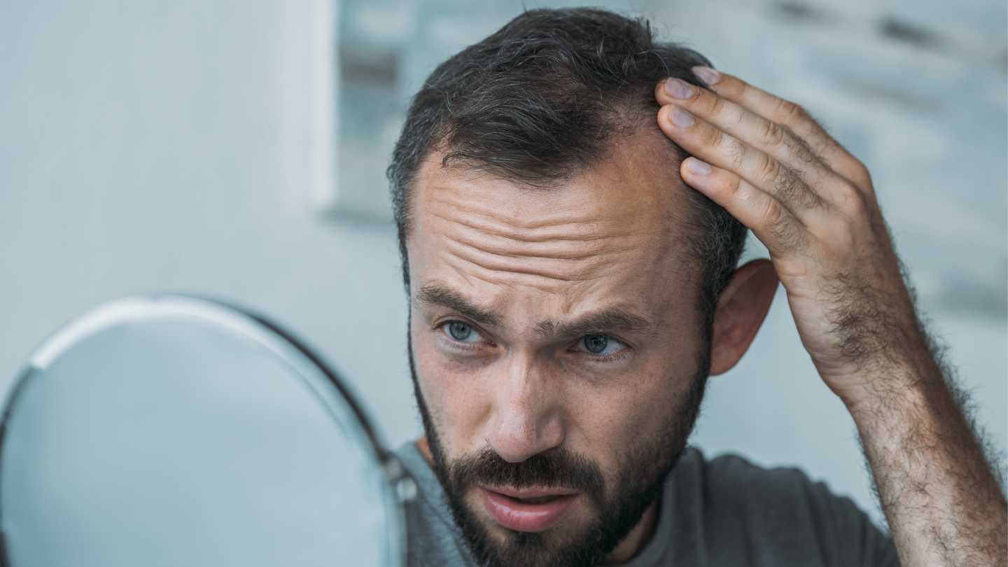 acupuncture for hair loss