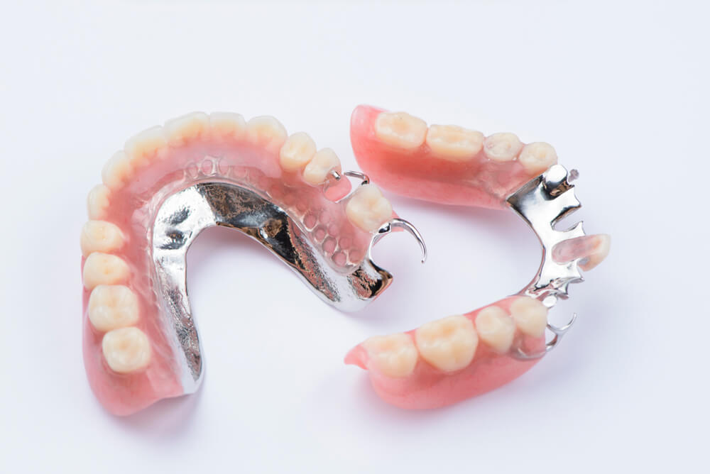 Removable metal partial denture