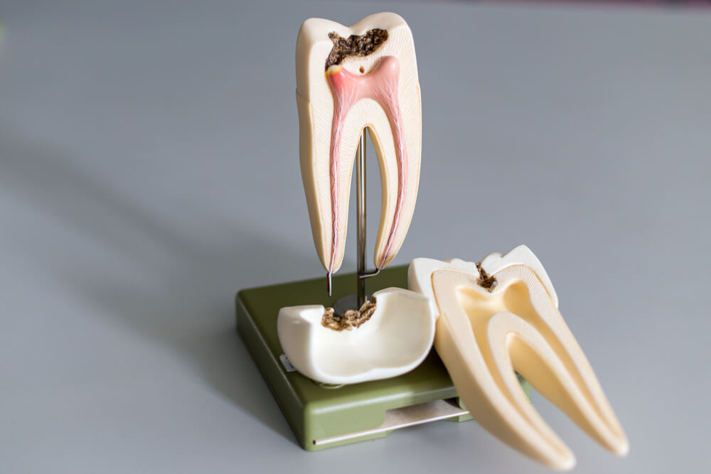 Tooth model for education in laboratory